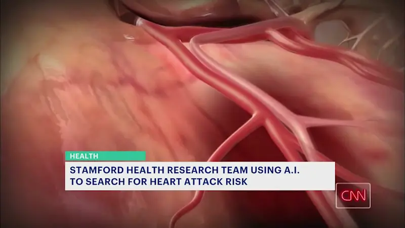 Story image: Stamford Health researchers using AI to determine a person's risk of having a heart attack 