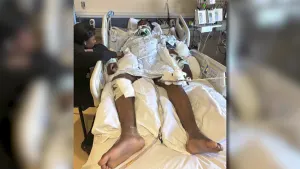 Bridgeport teen hit by car returns home after month-long hospitalization
