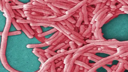 RTBXLegionnairesDiseaseUpdateNHernandez9pm_2026-09-20-21-55-53