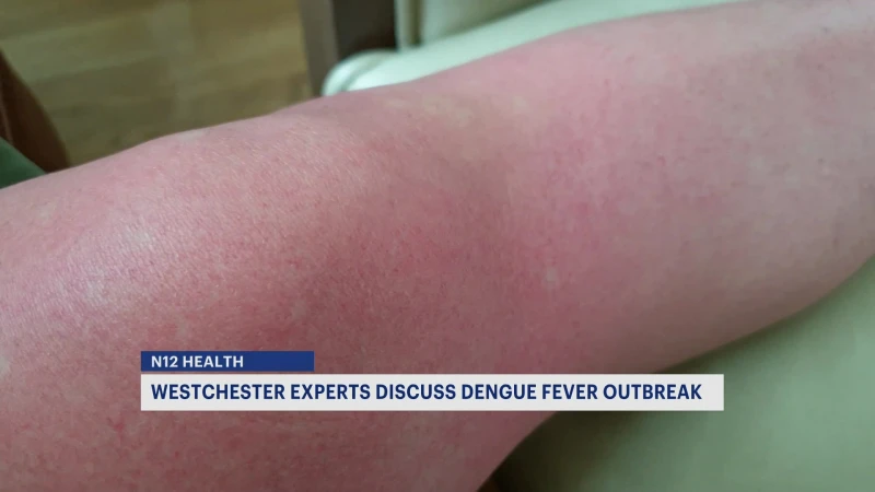 Story image: Local doctor warns travelers of dengue fever outbreak in Puerto Rico