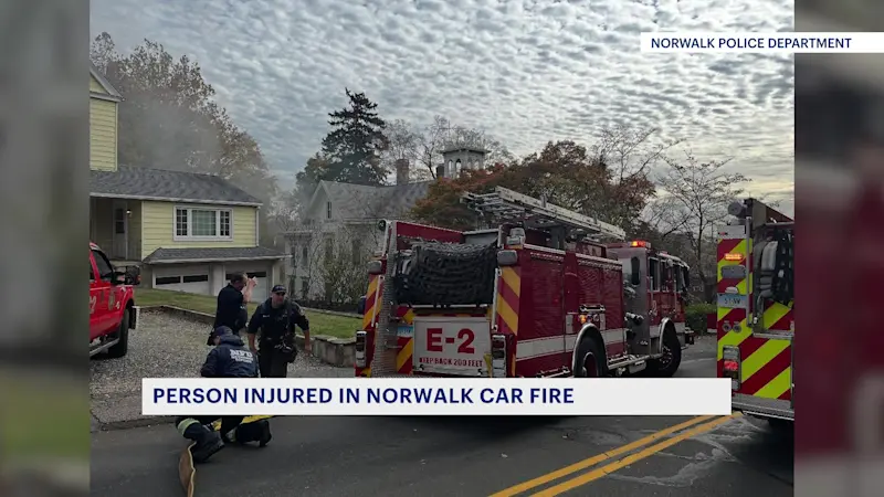 Story image: 1 taken to Bridgeport Hospital's burn unit following Norwalk car fire 