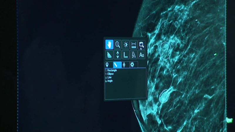 Story image: How AI is helping detect breast cancer early   