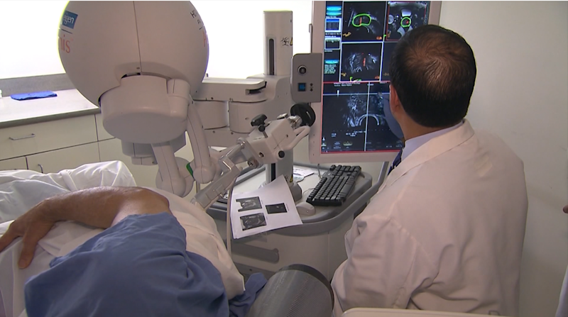 Story image: Doctors worry as colorectal cancer deaths rise among younger adults