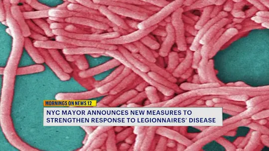 LegionnaireDisease91_2026-09-01-05-40-51