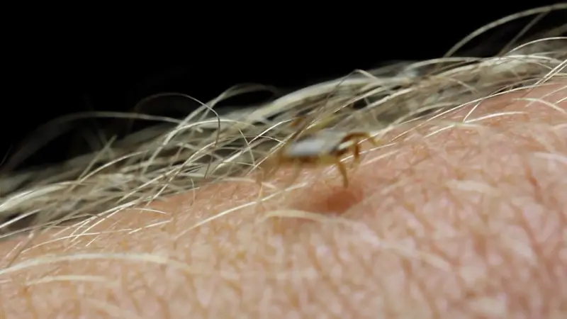 Story image: be Well: What to do if you find a tick on your pet