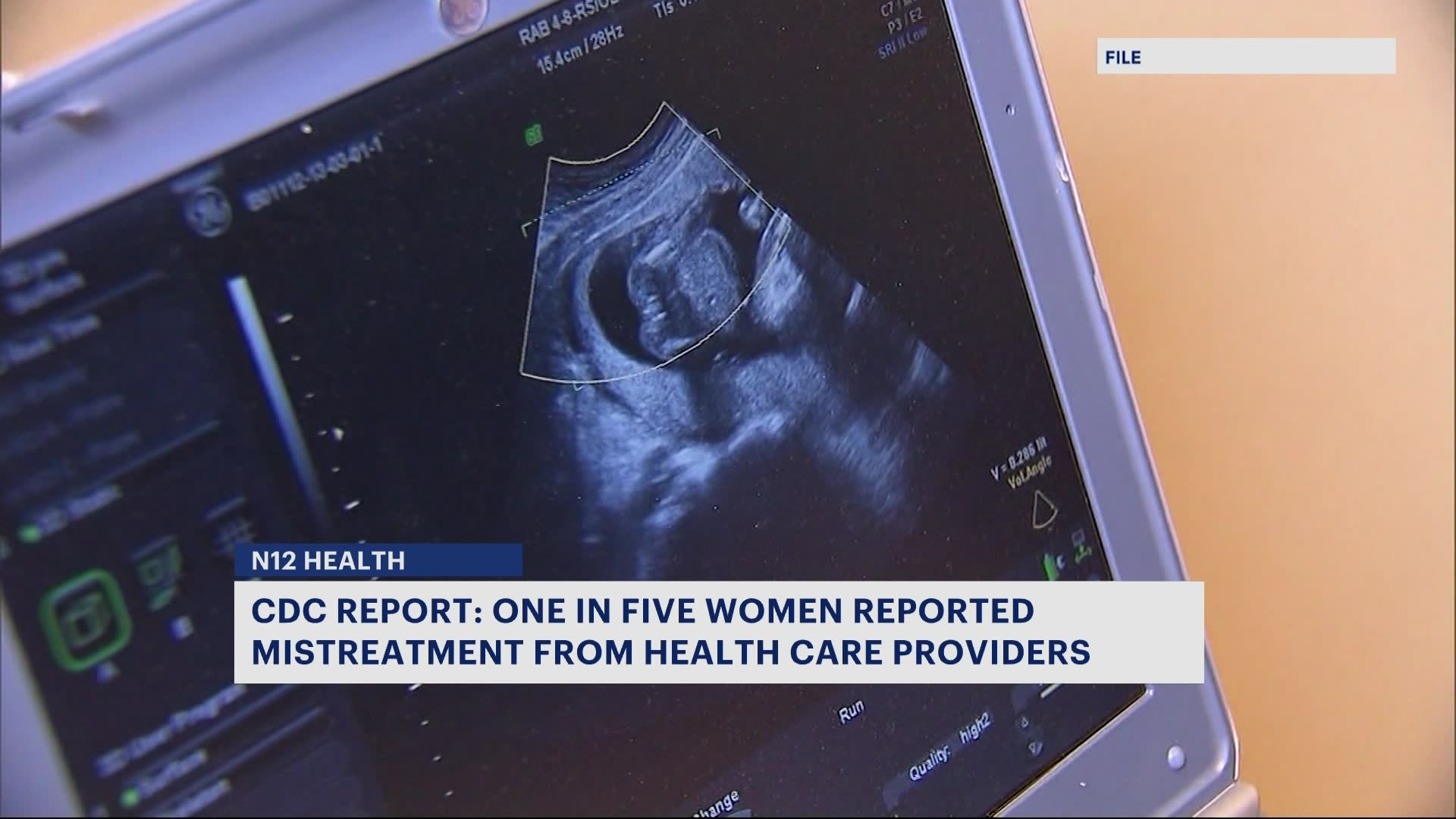 CDC report 1 in 5 women mistreated while receiving maternity care, 30(00)