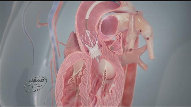 Article 107902 Thumbnail