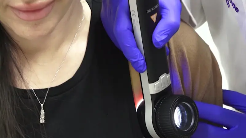 Story image: Local doctors urging Long Islanders to protect themselves against melanoma
