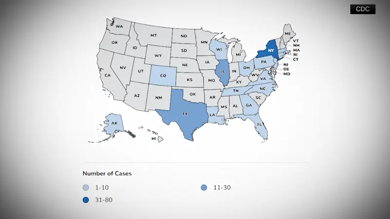 Story image: Connecticut cases of intestinal parasite rise to 30, health department says