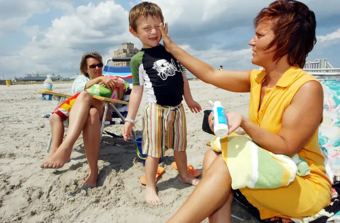 Story image: Spent some time in the sun? Here are 18 tips to treat sunburn in adults and children