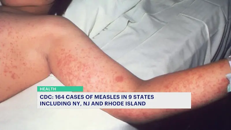 Story image: Doctor: Connecticut ‘exceedingly well vaccinated’ against measles amid rising cases