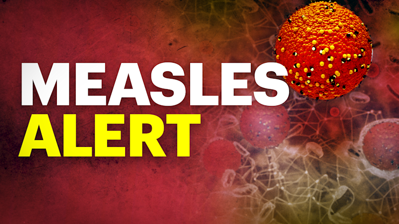 Story image: NJ Health Department confirms case of measles in Hudson County