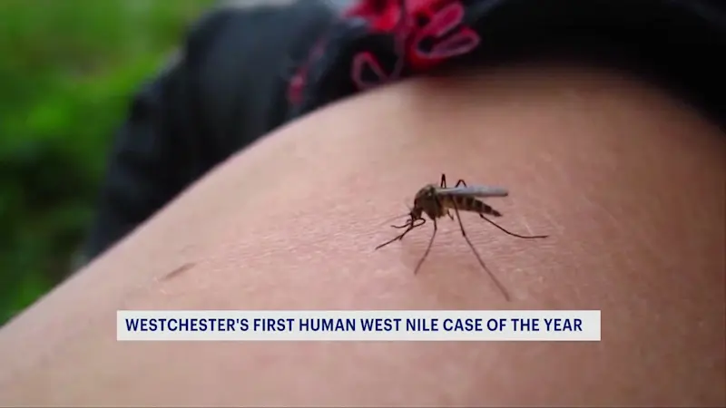 Story image: Doctor issues warning about West Nile virus after Westchester case