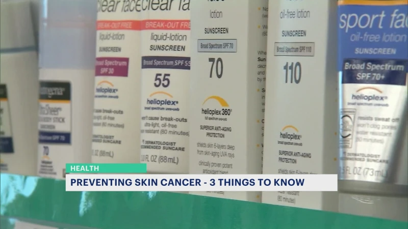 Story image: Preventing skin cancer: 3 tips for a safe summer in the sun