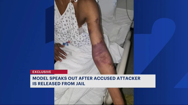 Story image: Bronx woman says neighbor who stabbed her is out on supervised release and fears he will strike again