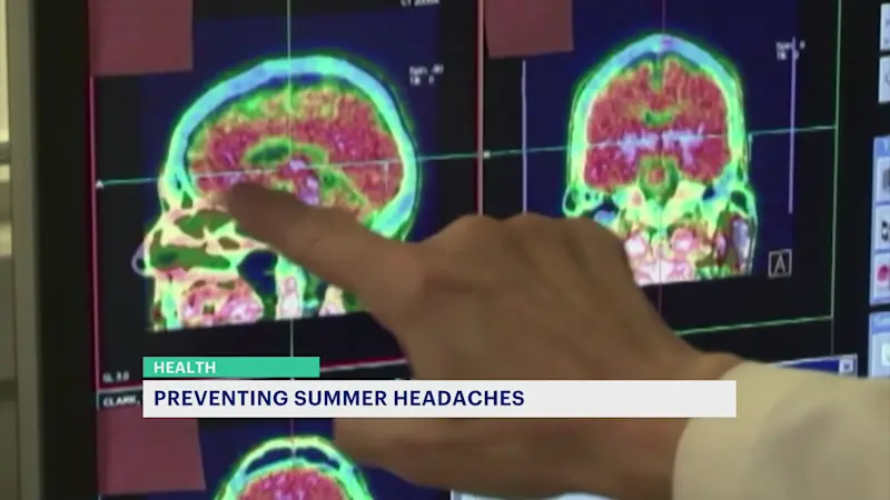 Story image: Combatting summertime headaches and migraines