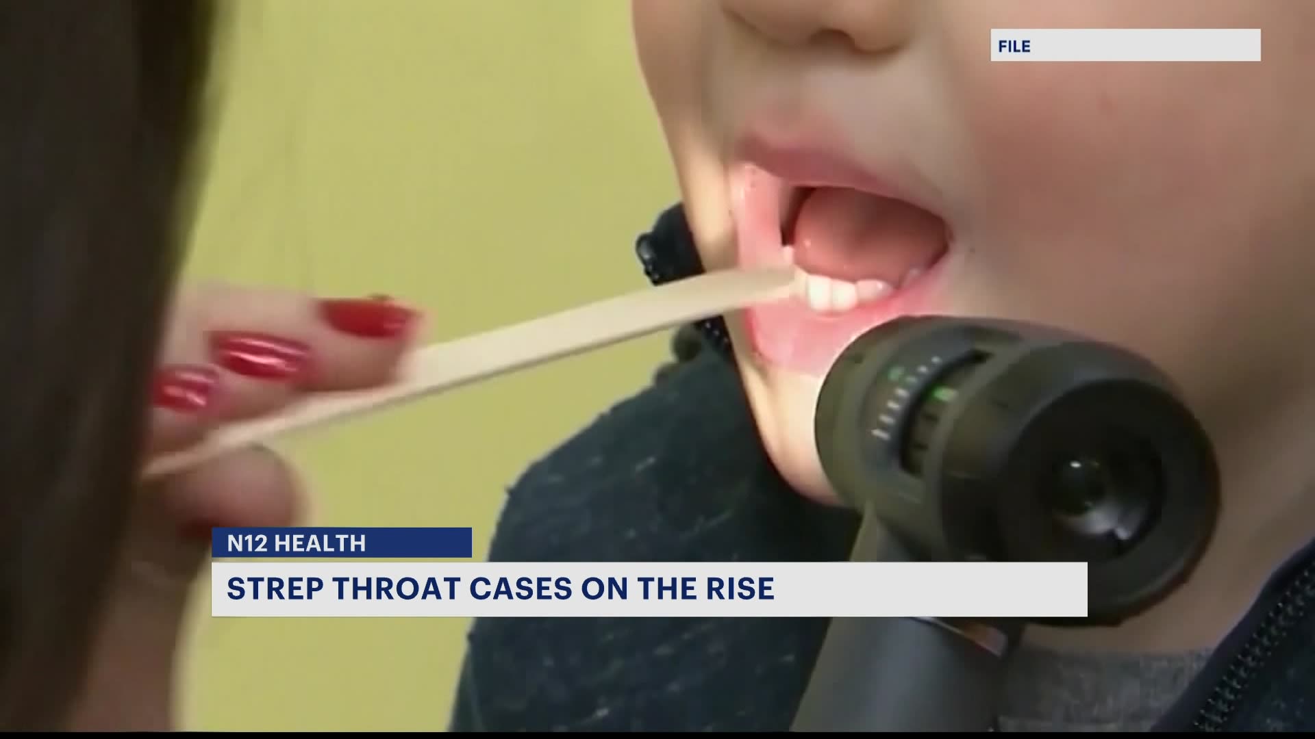 Doctors Warn Of Rise In Strep Throat Cases 