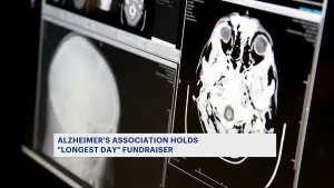 Alzheimer's Association encourages people to come up with creative ways to fundraise for research efforts