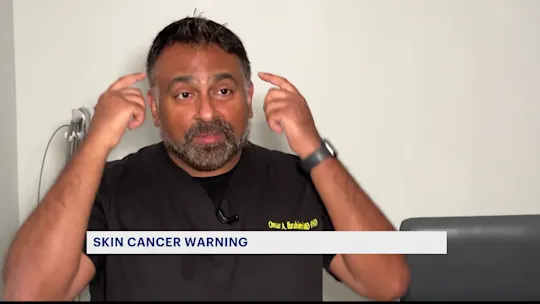 SkinCancer624_2024-06-24-11-57-06