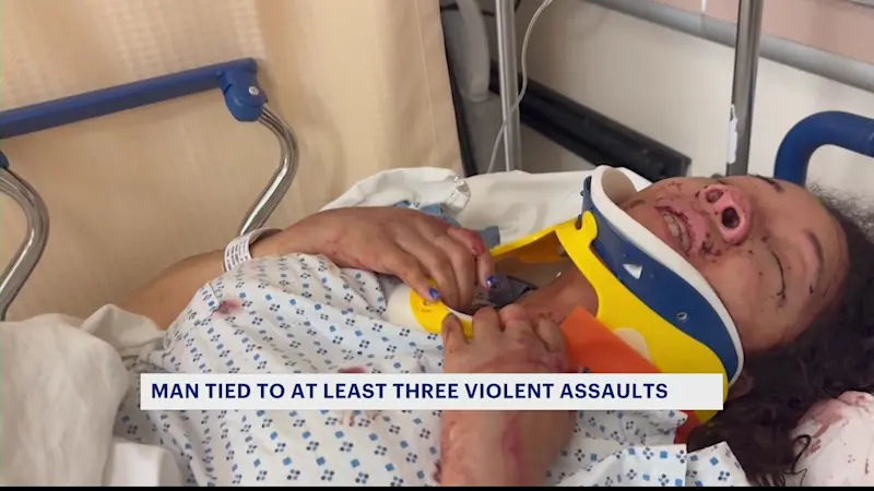 Story image: Man arrested for brutal assault linked to 3 attacks; victim speaks out
