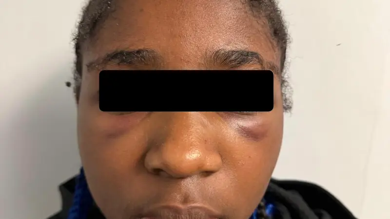 Story image: Video shows bus attack that left Pomona Middle School girl with broken nose