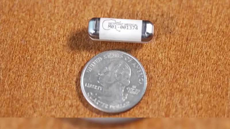 Story image: Implanted computer chip helps alleviate rheumatoid arthritis pain in clinical trial