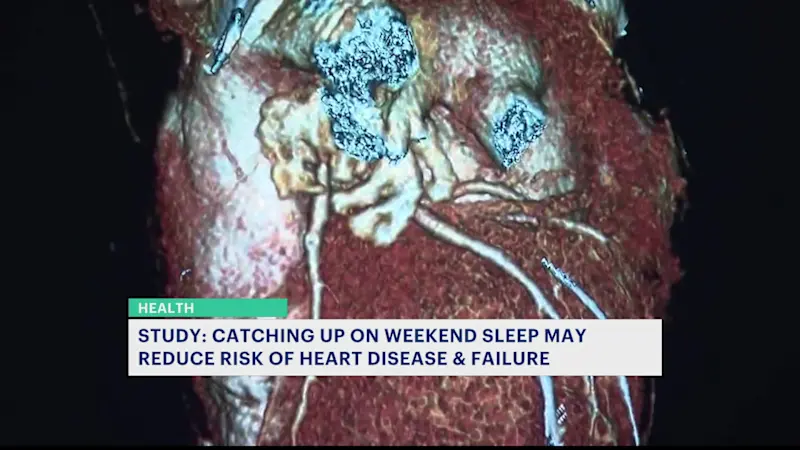 Story image: Study: Catching up on weekend sleep may reduce risk of heart disease & failure