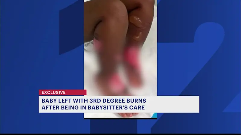 Story image: Brooklyn family seeks answers after toddler comes home from babysitter with third-degree burns