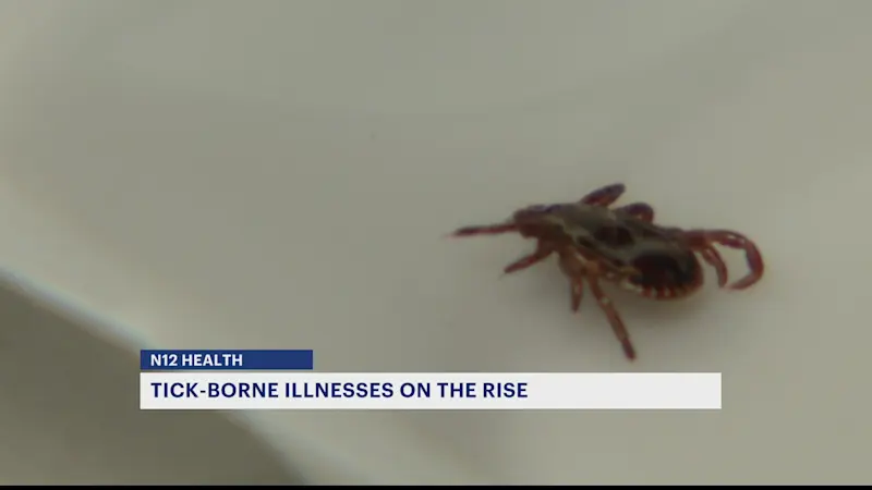 Story image: CDC: Number of tick-borne illnesses have quadrupled over the past 2 decades