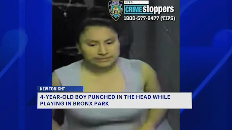 Story image: Bronx mother says police never showed up after 4-year-old son was allegedly punched at park