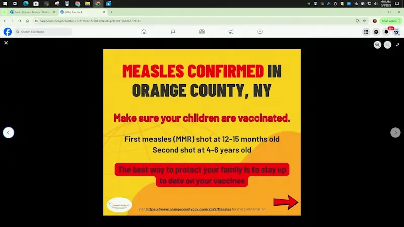 Story image: Measles confirmed in Orange County as U.S. cases top 1,000