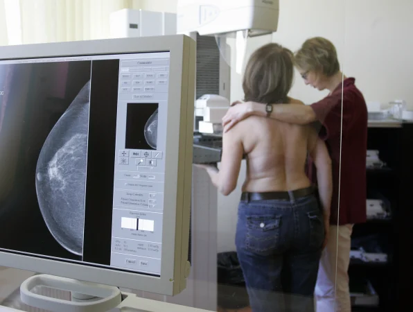 Story image: Getting a mammogram for the first time? Here are 19 things you should expect