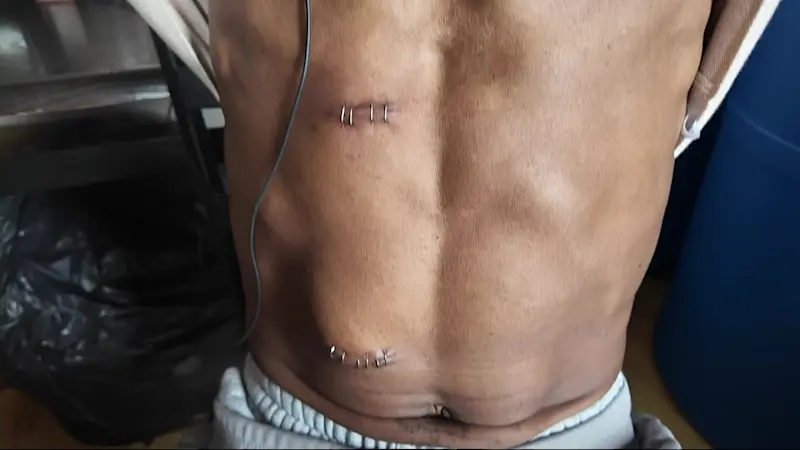 Story image: Victim speaks out following stabbing in his Bed-Stuy home, 2 attackers sought