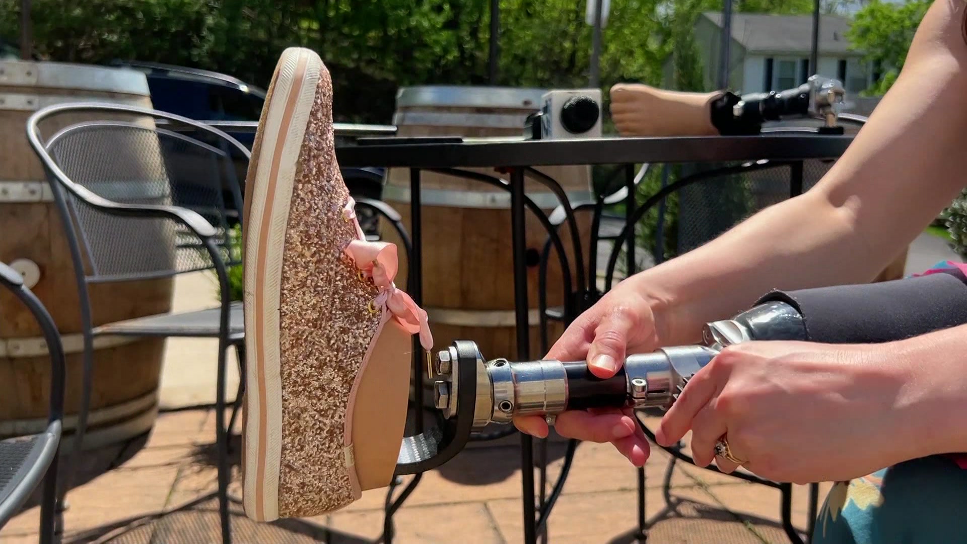 0417amputee_2026-04-17-18-04-27