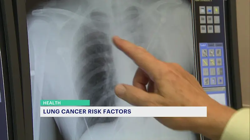 Story image: Lung cancer remains the deadliest cancer in the US. Here's what you need to know