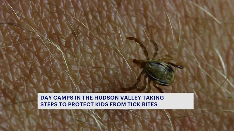 Story image: Spike in tick bites raises concerns at Hudson Valley summer camps