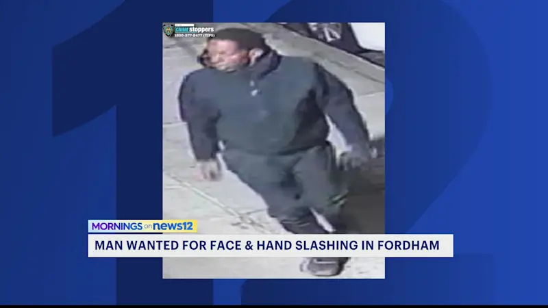 Story image: Man wanted for assault in Fordham