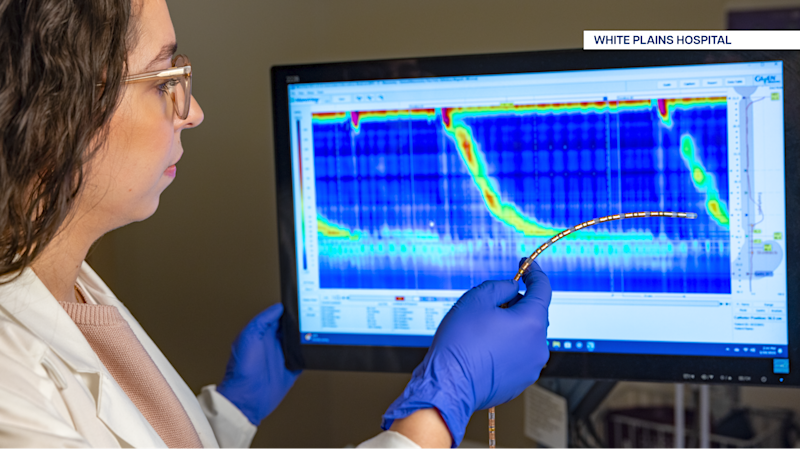 Story image: New technology offers new way to diagnose chronic heartburn at White Plains Hospital