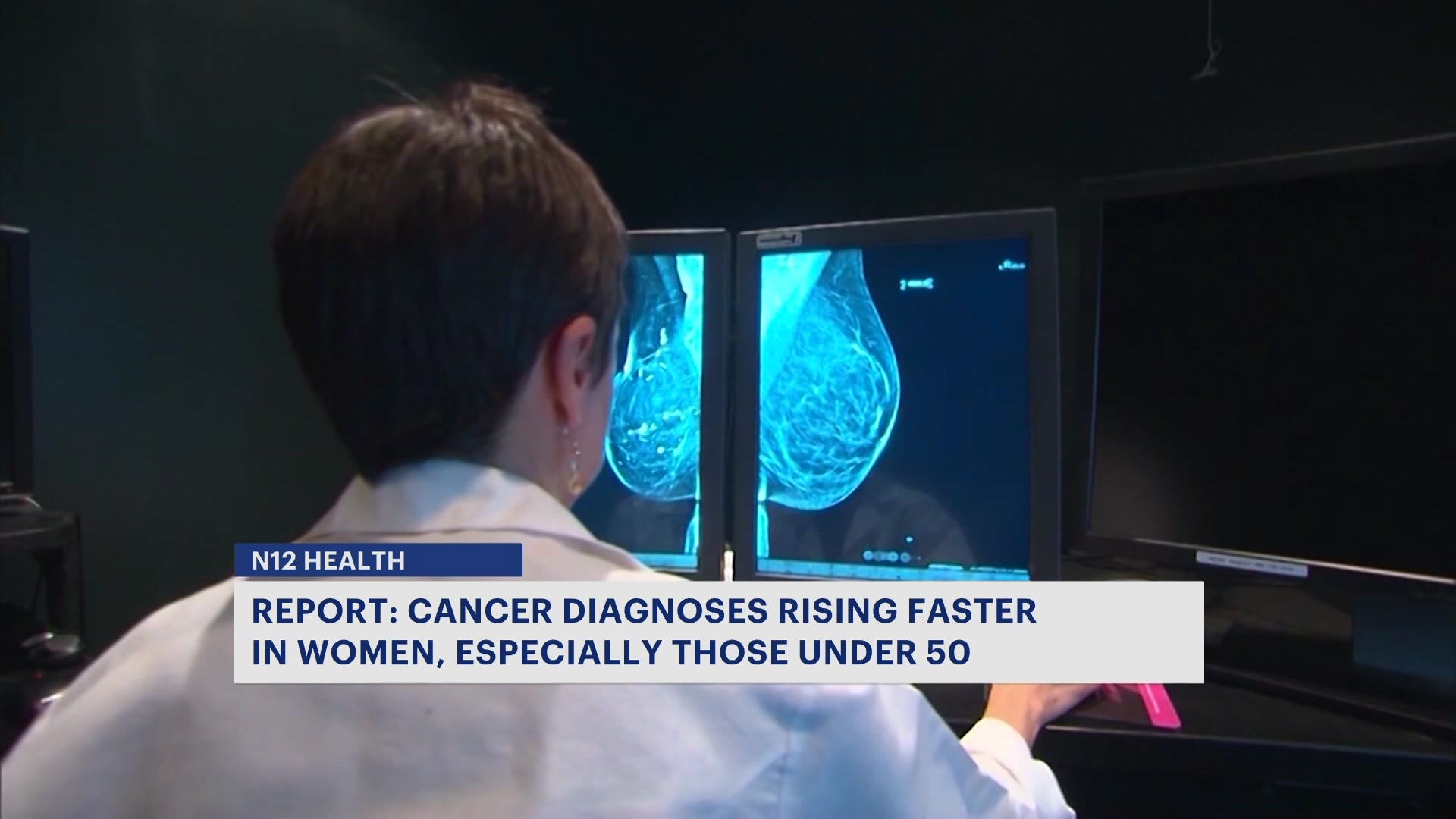 Report: Cancer diagnoses on the rise in younger women