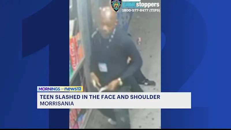Story image: Teen slashed in the face and shoulder after argument in Morrisania