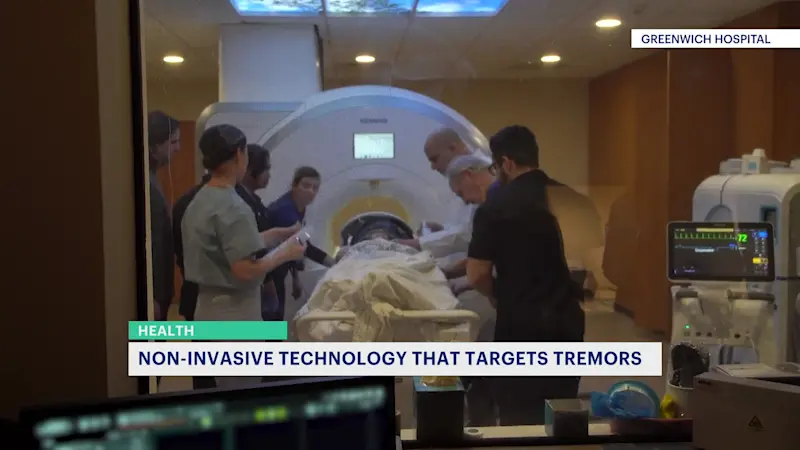 Story image: Greenwich doctor explain high-tech treatment to improve Parkinson's tremors 