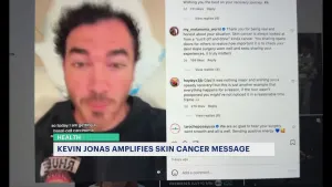 Kevin Jonas undergoes surgery to remove common skin cancer; urges fans to get checked