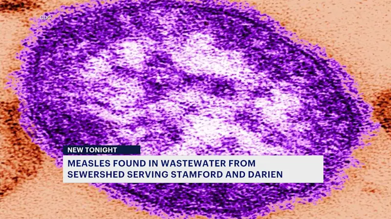 Story image: Measles detected in wastewater samples from sewershed serving Stamford and Darien
