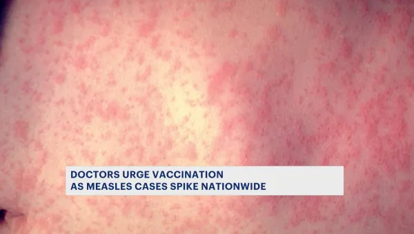 Health officials sound the alarm as measles cases spike across the country