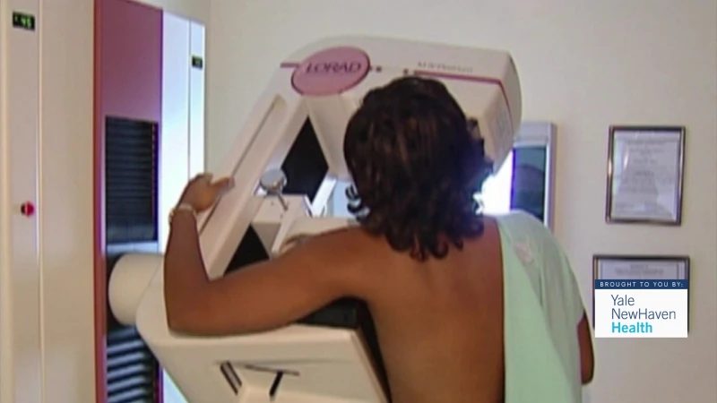 Story image: be Well: How breast cancer screenings can save lives