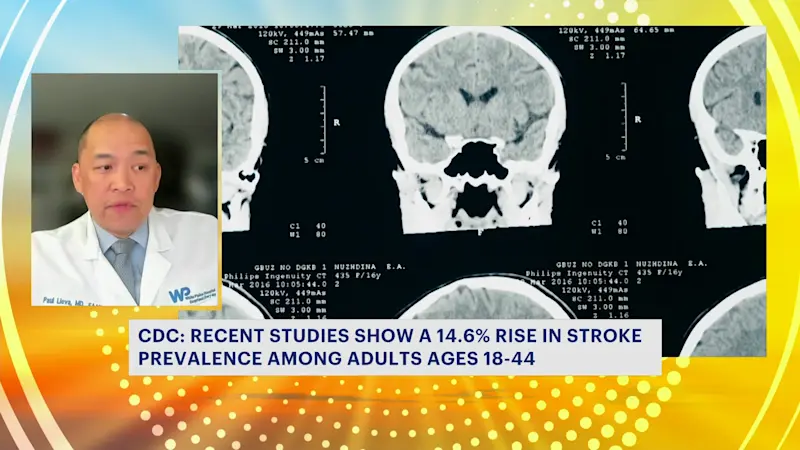 Story image: Young people urged to know stroke risks, signs