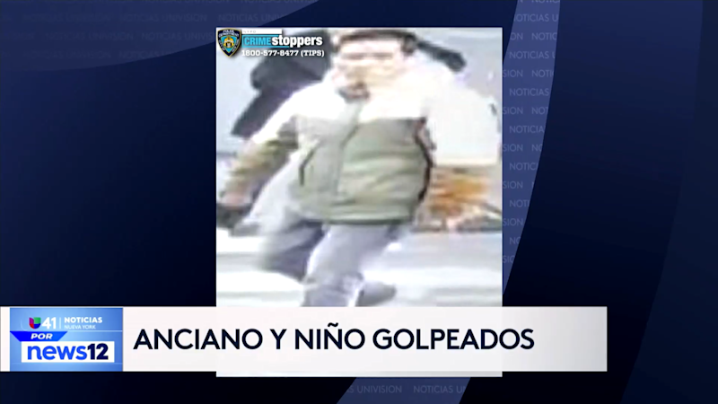 Story image: Univision 41 News Brief: Anciano y nino golpeados