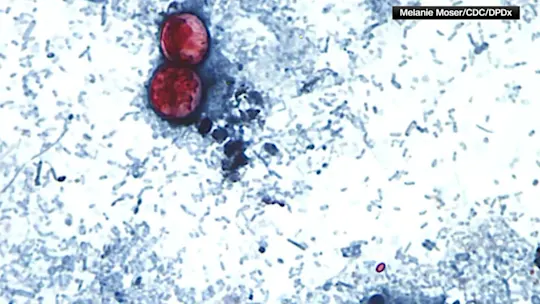 78clycospora_2026-07-08-07-23-41