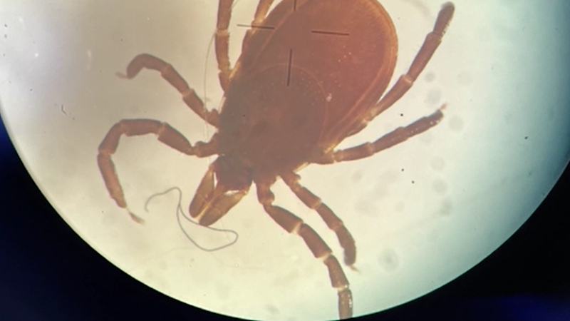 Story image: Tick danger rising as officials report high rates of disease-carrying ticks this summer