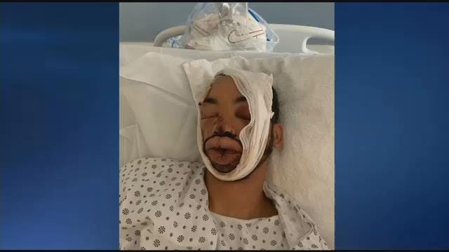 News 12 | Long Island | Man Allegedly Catapulted Into Wall By Police ...